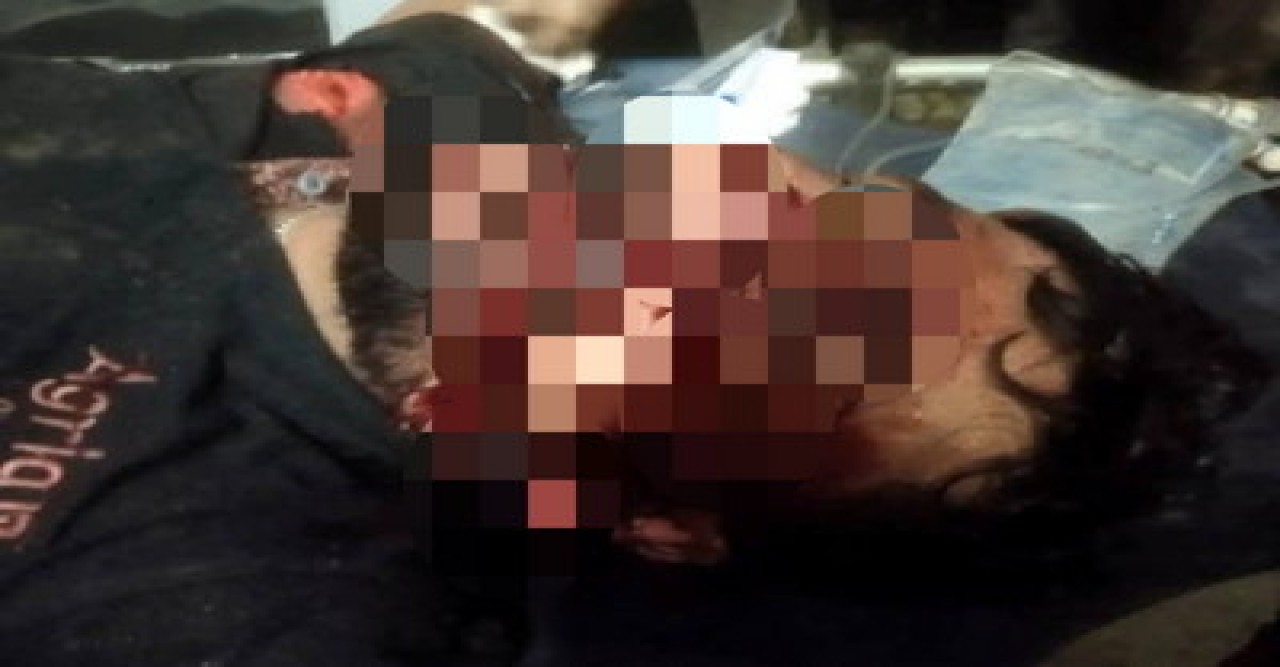 খাগড়াছড়িতে বিএনপি নেত্রীর ভাইকে কুপিয়ে গুরুতর জখম