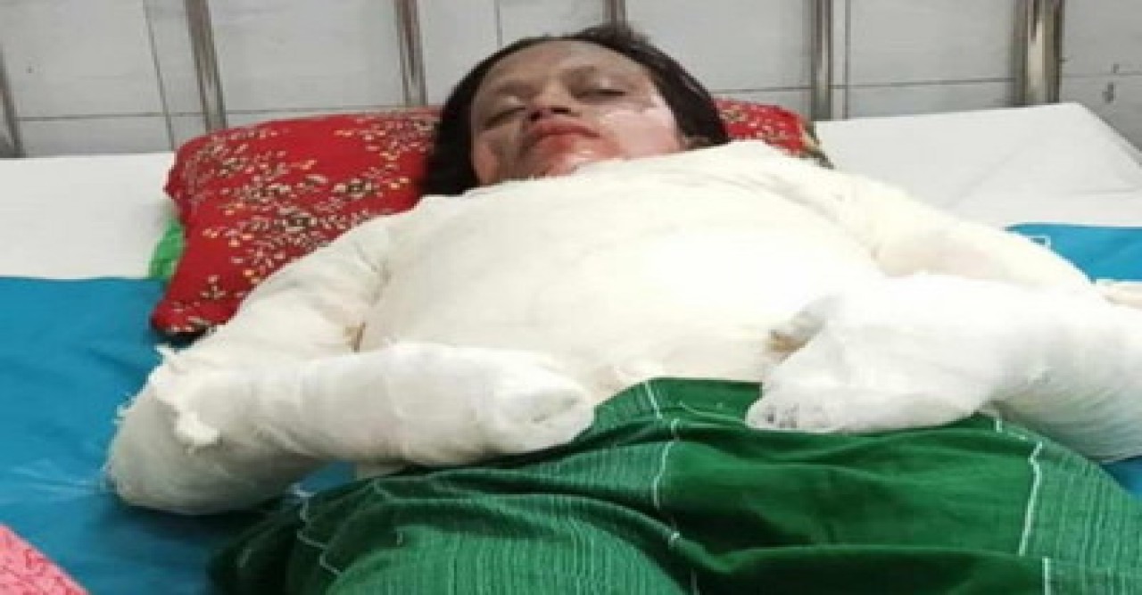 বাঘায় শরীরে ডিজেল ঢেলে আগুন ধরিয়ে পুড়ে মরলো গৃহবধু!