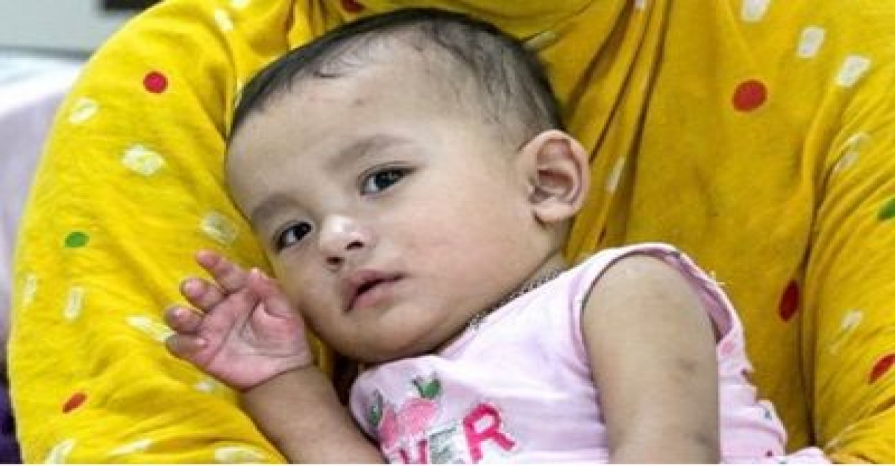 দেশে হাম উপসর্গে আরও ৯ শিশুর মৃত্যু