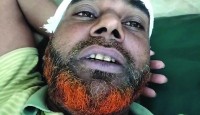 নাটোরে ছিনতাই দুই পাট ব্যবসায়ীকে পিটিয়ে ৫ লক্ষাধিক টাকা