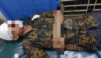 মান্দায় সড়ক দুর্ঘটনায় দুই বন্ধু নিহত, আহত ৪